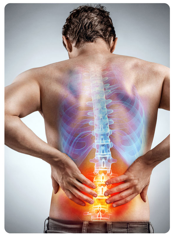 Pinched nerve in lower back: Causes & Treatment of nerve pain