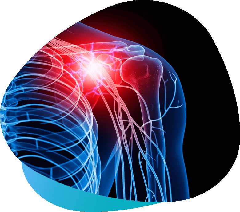 Albuquerque Back & Neck Pain Treatment: Pinched Nerve: Dr. Raiten